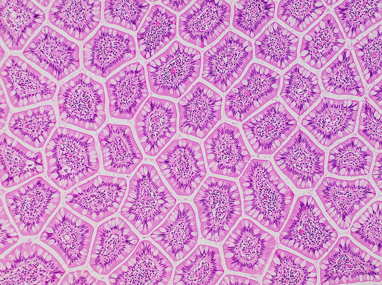H&E-stained transverse profiles of terminal ileal villi. Pale goblet cells interrupt the columnar epithelium around each villus; its lamina propria forms the core.
